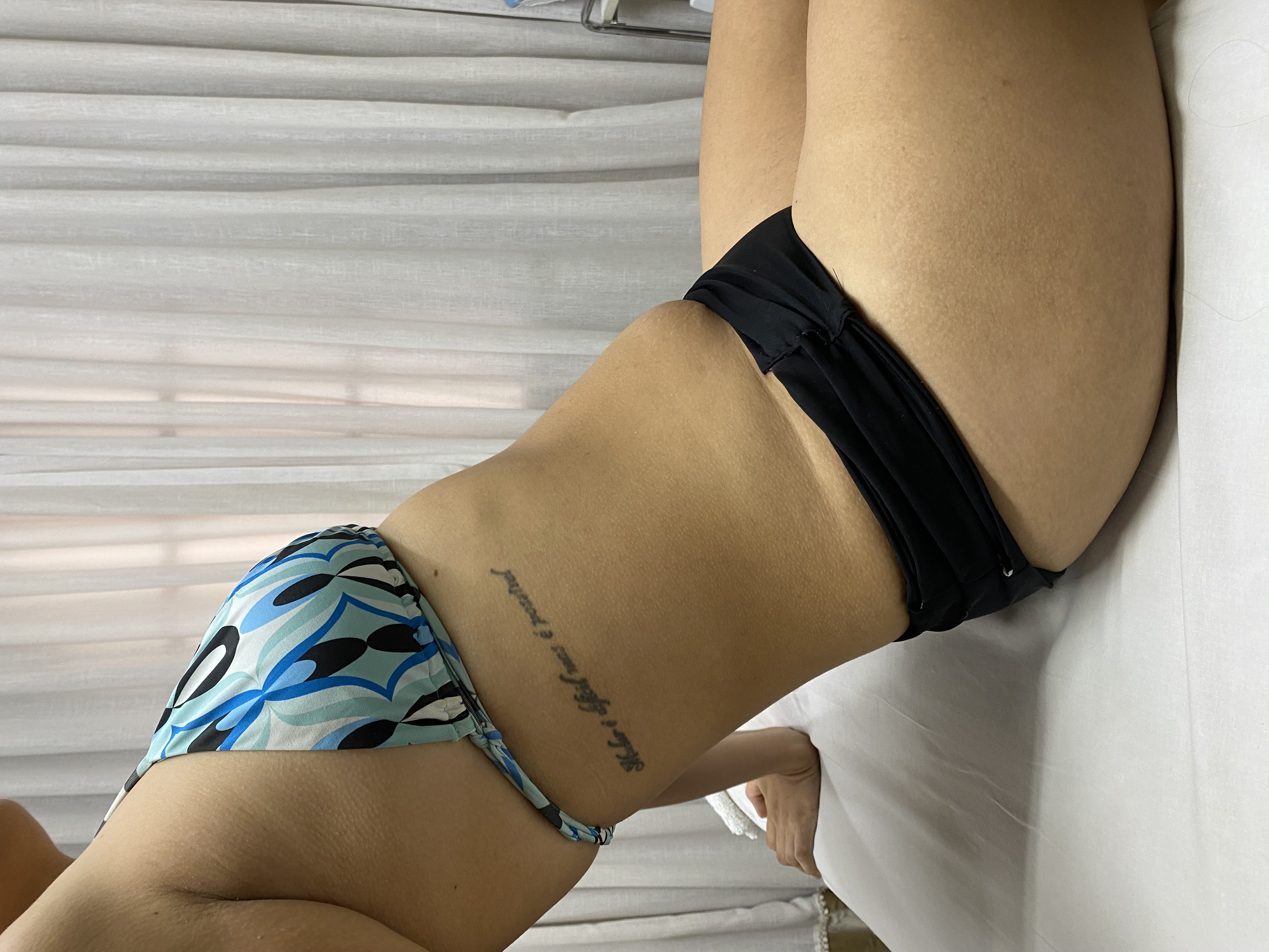 Paciente 1 — depois